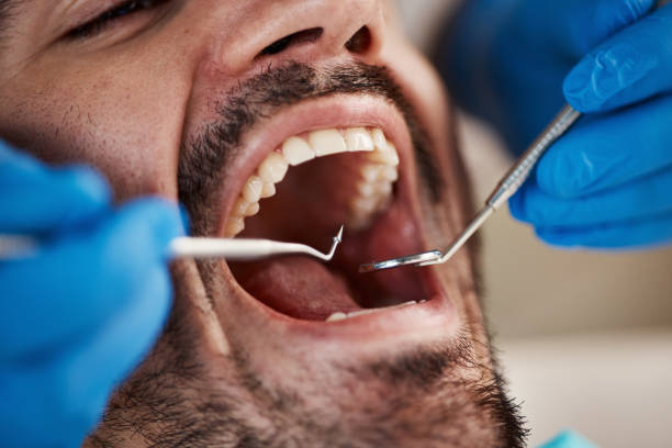 Best Chipped Tooth Repair Near Me  in Memphis, TN